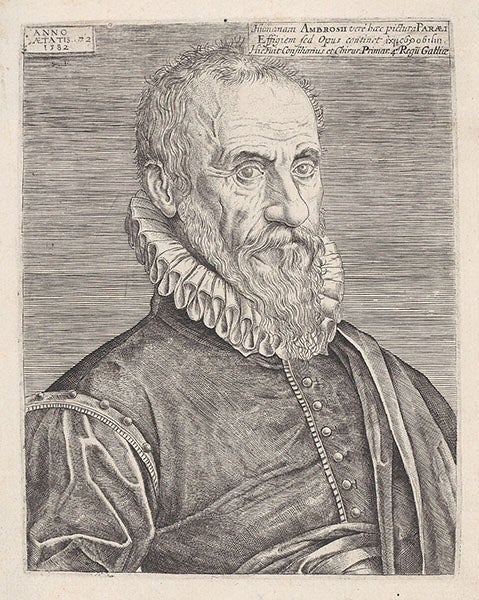 Portrait of Ambroise Paré, age 72, engraving by Stephanus Delaune, 1582, Metropolitan Museum of Art, New York (metmuseum.org)