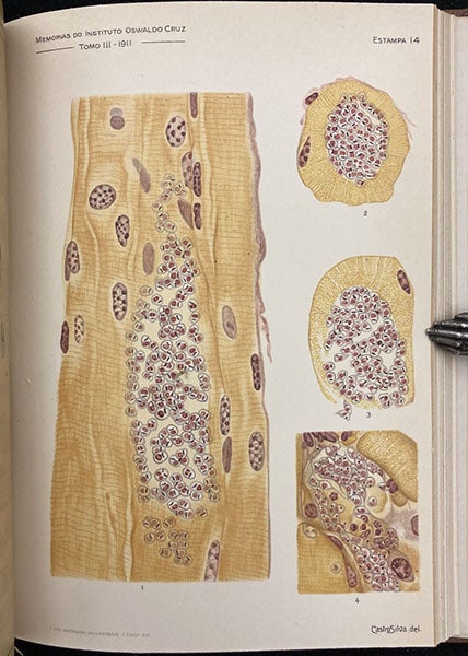 Muscle issue infected by trypanosomes, painting by Manuel de Castro Silva, Memorias do Instituto Oswaldo Cruz, vol. 3, plate 14, 1909 (Linda Hall Library)