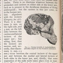 Side view of the Taung skull, with brain cast, detail of photograph from “Australopithecus africanus: The man-ape of South Africa,” by Raymond Dart, Nature, vol. 115, Feb. 7, 1925 (Linda Hall Library)